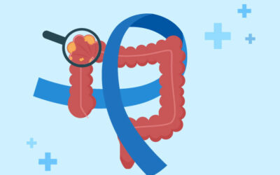 Mars bleu, mois de sensibilisation au dépistage du cancer colorectal